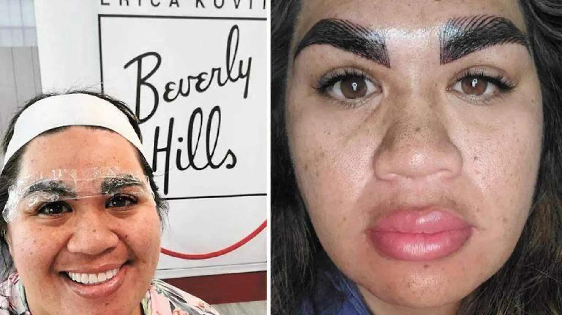 Con sus cejas como evidencia, una madre advierte de los peligros del maquillaje semipermanente